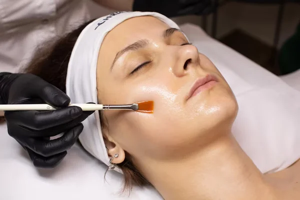 Chemical peels