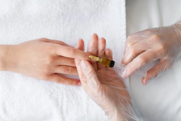 Hands Chemical peel