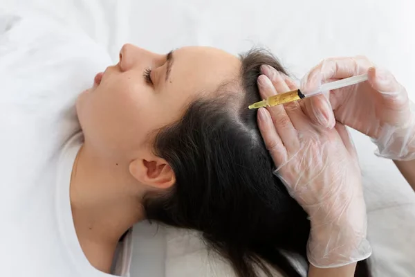 PRP for Hair