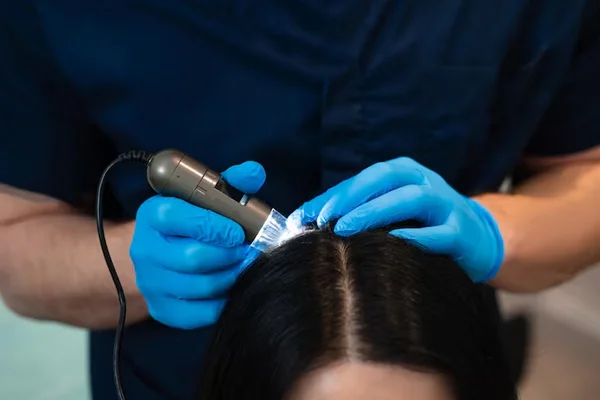 Scalp Microneedling
